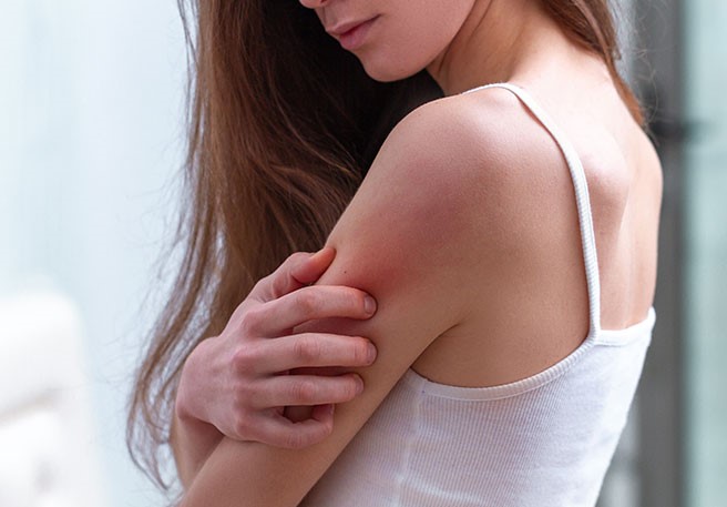 Frau kratzt sich am Oberarm Juckreiz als Symptom der polymorphen Lichtdermatose